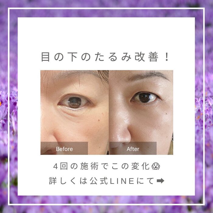 画像295